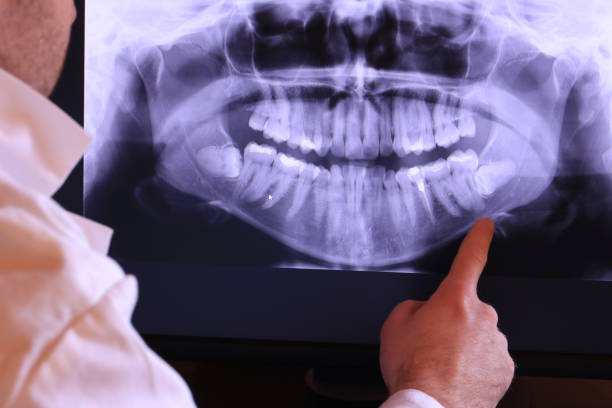 Best Emergency Gum Pain Relief  in Elmo, TX